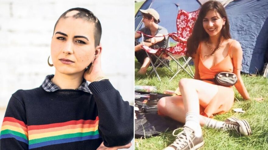 Genç kadın korona virüs nedeniyle saçlarını kaybetti