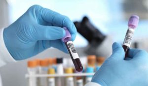 50’den fazla kanser türünü erken teşhis edecek kan testi deneniyor