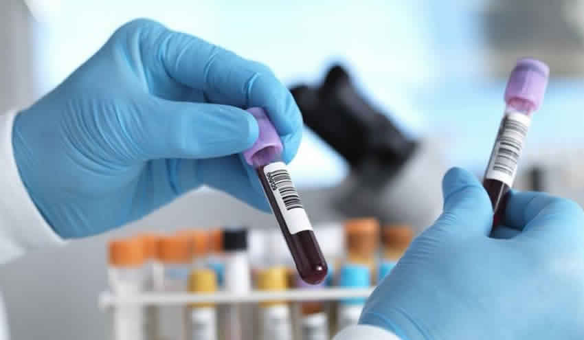 50’den fazla kanser türünü erken teşhis edecek kan testi deneniyor
