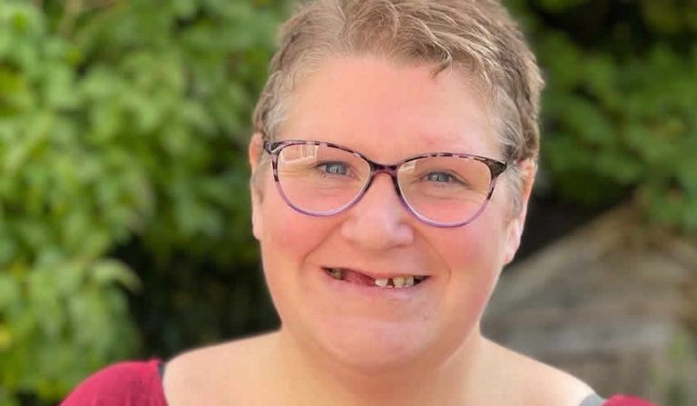 11 dişini kendisi çeken kadın İngiltere’de gündem oldu