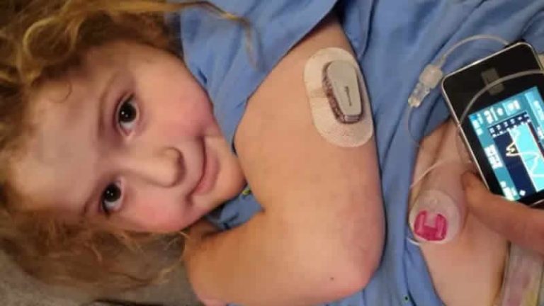 Diyabet tedavisinde devrim yapabilecek yapay pankreas cihazı test aşamasında