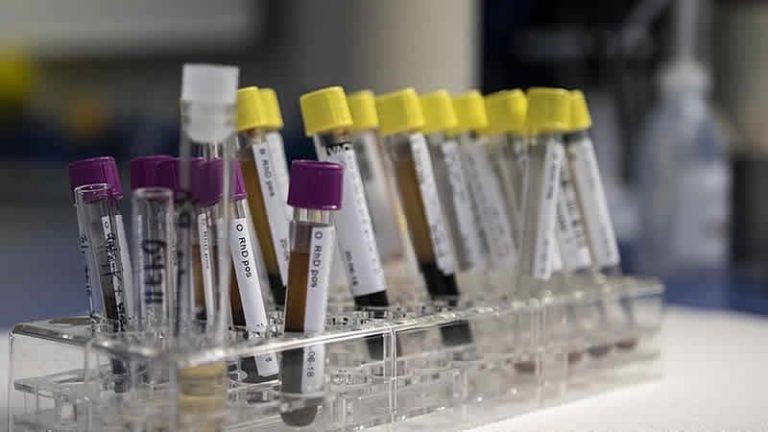 İngiltere’deki gizemli hepatit virüsü Avrupa ve ABD’de yayılmaya başladı