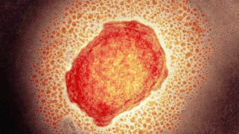 Maymun çiçeği (monkeypox) virüsünün cinsel sağlık üzerindeki etkisi endişeye neden oldu