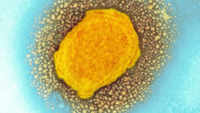 İngiltere'de iki monkeypox (maymun çiçeği) vakası daha tespit edildi