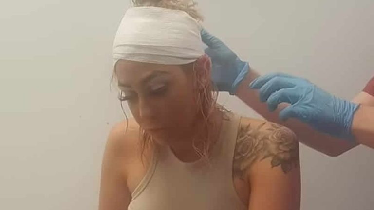 Londra’da bir kuaförde saçını boyatmak isteyen genç kadın kabusu yaşadı