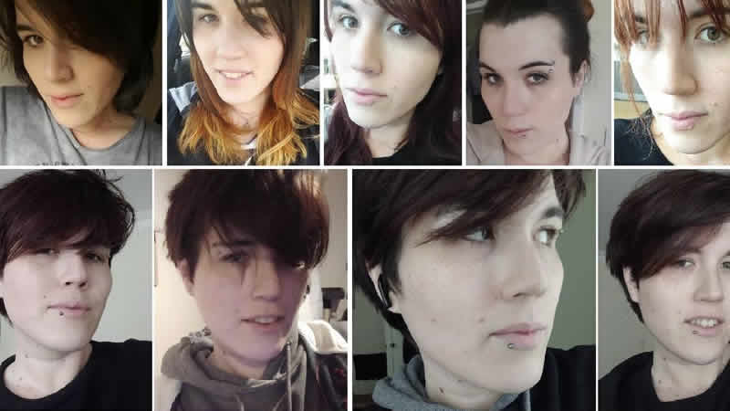 NHS tarafından cinsiyet değiştirme operasyonuna yönlendirilen kişi dava açıyor