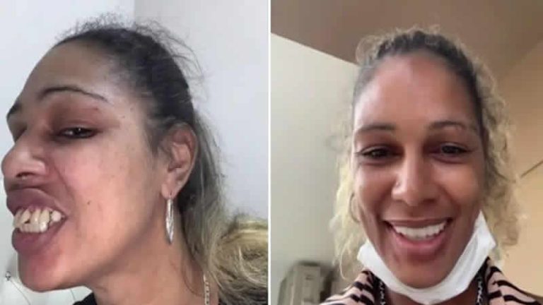 İngiltere’de 22 bin sterlin tutan tedaviyi Türkiye’de 6 bin sterline yaptırdı