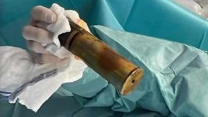 Anüsüne top mermisi sıkışan kişi acile gitti; hastane patlama riskine karşı boşaltıldı