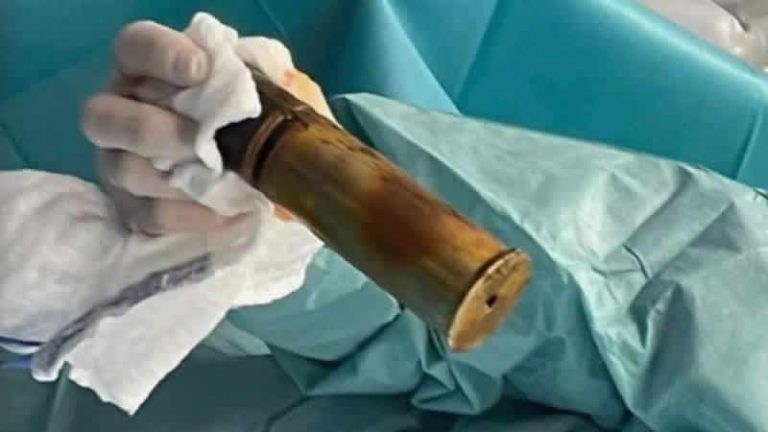 Anüsüne top mermisi sıkışan kişi acile gitti; hastane patlama riskine karşı boşaltıldı