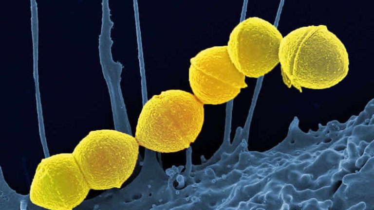 İngiltere’de “Strep A” nedeniyle ölüm sayısı artıyor