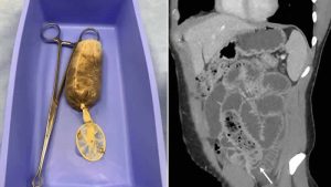 Midesinden öyle bir şey çıktı ki…!