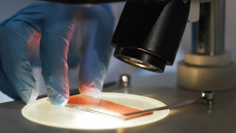 İngiltere’de umut veren kanser testi