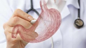 İngiltere’den sonra Almanya da Türkiye’de mide botoksu yaptıranları uyardı