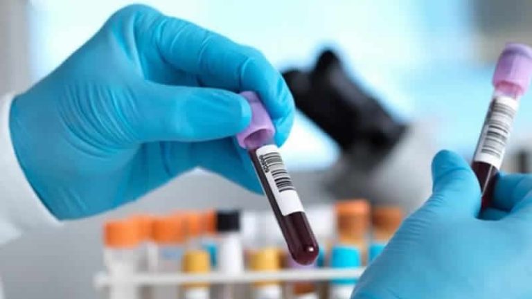 İngiltere’de yapılan kan testi, her üç kanserden ikisini tespit edebildi