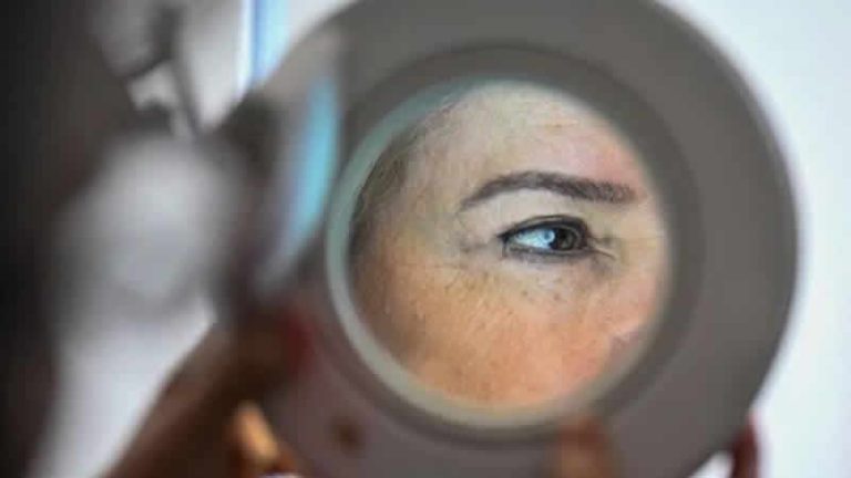 İngiltere’de cilt kanseri arttı