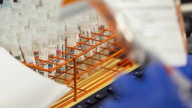 İngiltere’de Covid-19’un yeni varyantı “BA.2.86” ilk kez tespit edildi