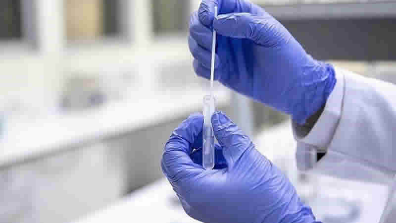 İngiltere’de Kovid-19’un yeni varyantı Eris’in yayıldığı bildirildi