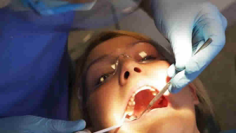 Rapor: İngiltere’de diş hekimliği hizmeti son 75 yılın en kötü seviyesinde