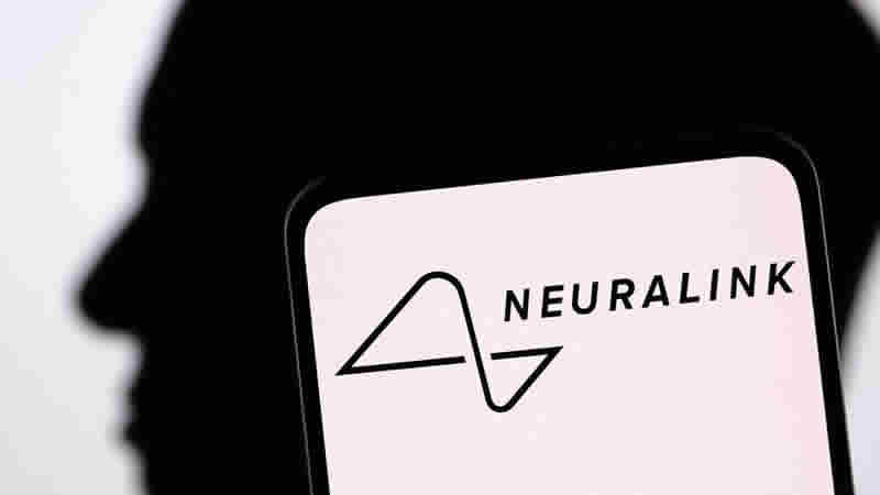 Elon Musk: “Neuralink’in beyin çipi ilk kez bir insana yerleştirildi”
