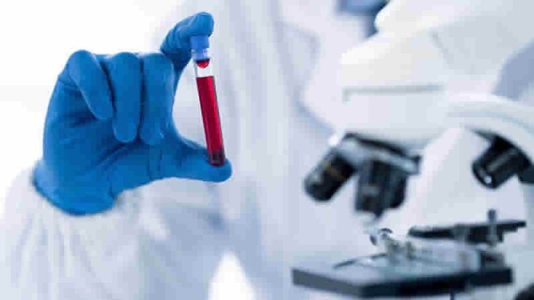 İngiltere’den Alzheimer tanısında devrim yaratacak çalışma