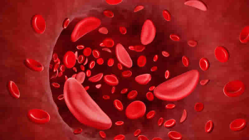 İngiltere’de “orak hücre hastalığı” için umut veren yeni tedavi