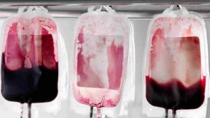 İngiltere’de kan skandalı: 90 gün içinde 210 bin sterlin tazminat ödenecek