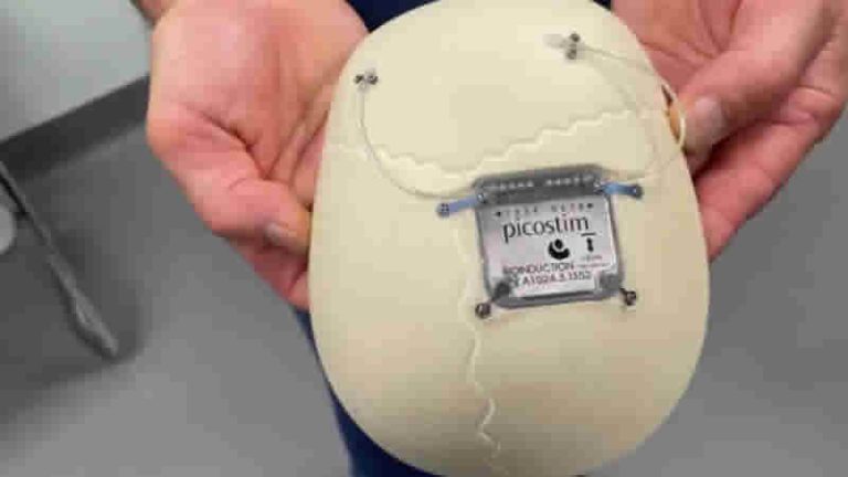 Dünyada bir ilk: İngiltere’de 13 yaşındaki çocuğun kafatasına epilepsi cihazı yerleştirildi