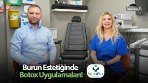 Burun estetiğinde botox uygulamaları…