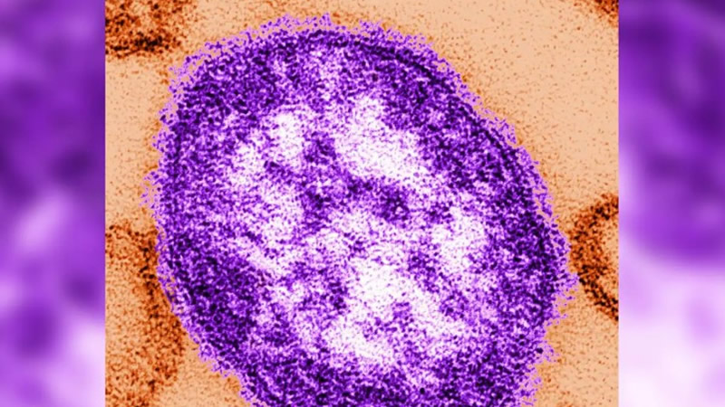 Liverpool’da Kızamık Nedeniyle Bir Çocuk Hayatını Kaybetti: Aşılama Çağrısı Yenilendi