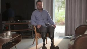 İngiltere’de Akılalmaz Olay: Cerrah Kendi Bacaklarını Kesti, Sigortayı Dolandırdı