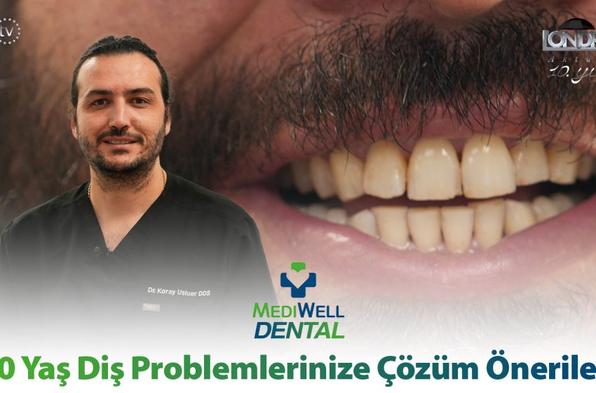 20 yaş diş problemlerinize çözüm önerileri…