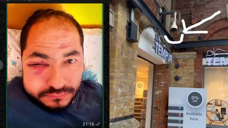 İngiltere’de Uğradığı Saldırı Sonrası Hayatı Altüst Olan Türk Genci Adalet Arıyor