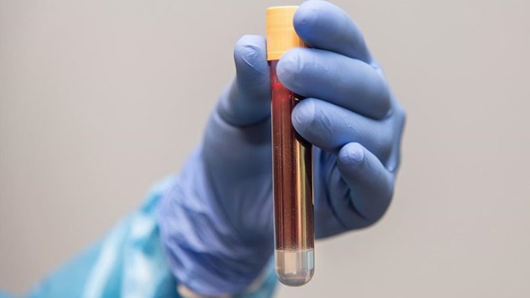 NHS, İngiltere’de Ölüm Riskini Yarı Yarıya Azaltabilen Prostat Kanseri İlacına Onay Verdi