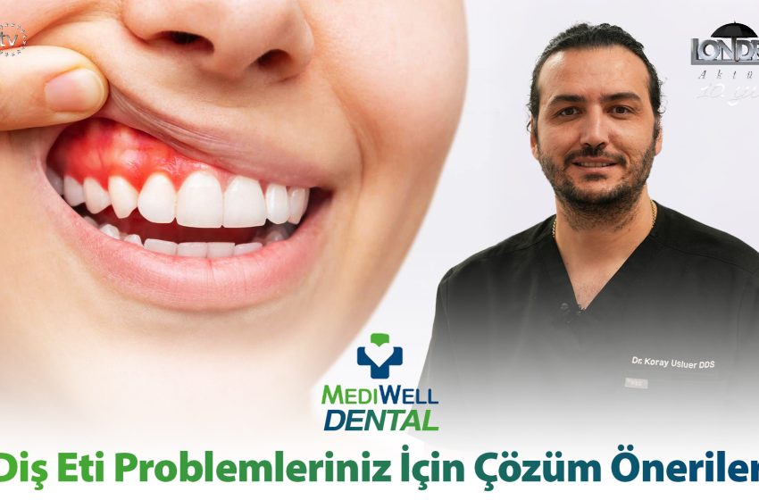  Diş eti problemleriniz için çözüm önerileri…