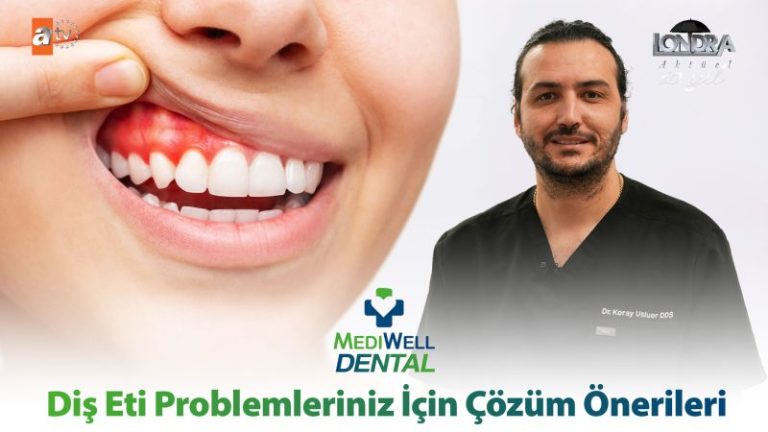 Diş eti problemleriniz için çözüm önerileri…