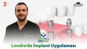 Londra’da implant uygulaması…